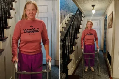 Amy Schumer Shocks Fans as She Emerges with a Walker Following Surfing Accident and Secret Spinal Surgery – What Happened Behind the Scenes?